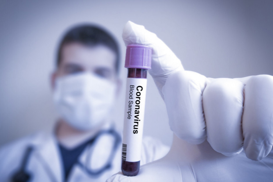 Koronawirus dotknął także pracowników Biedronki, fot. Shutterstock Ile przypadków COVID-19 było wśród pracowników Biedronki?