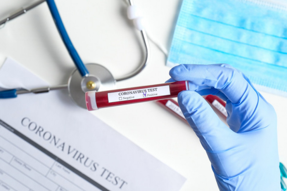 Przedsiębiorcy chcą ustawy, która pozwoli pytać pracowników czy są zaszczepieni. Fot. Shutterstock Przedsiębiorcy chcą ustawy, która pozwoli pytać pracowników czy są zaszczepieni